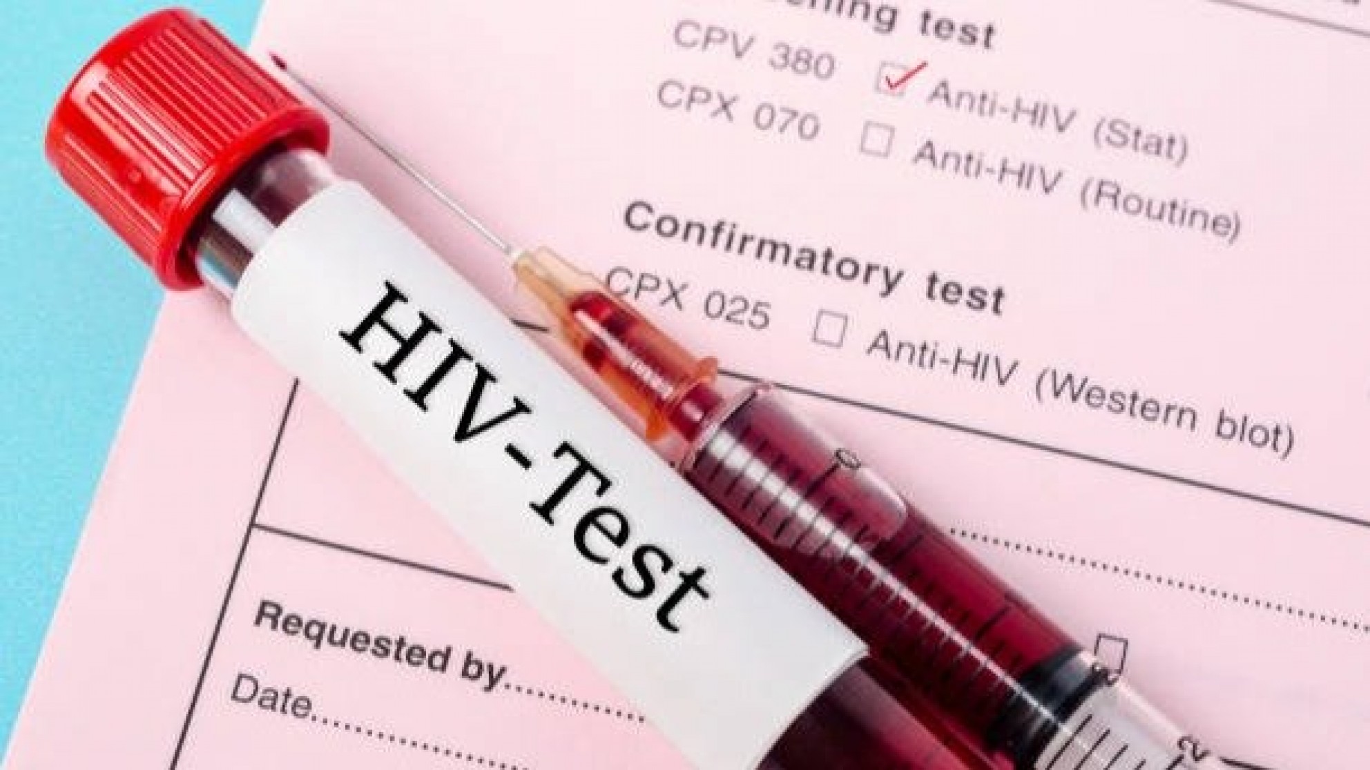 El lunes se realizaran testeos gratis por Día Internacional de la Prueba de VIH